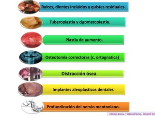 Cirugia Pre Protesica Final