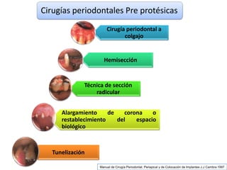 Cirugia Pre Protesica Final