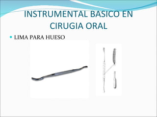 INSTRUMENTAL BASICO EN CIRUGIA ORAL LIMA PARA HUESO 
