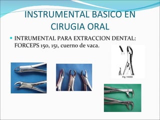 INSTRUMENTAL BASICO EN CIRUGIA ORAL INTRUMENTAL PARA EXTRACCION DENTAL: FORCEPS 150, 151, cuerno de vaca. 