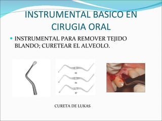 INSTRUMENTAL BASICO EN CIRUGIA ORAL INSTRUMENTAL PARA REMOVER TEJIDO BLANDO; CURETEAR EL ALVEOLO. CURETA DE LUKAS 