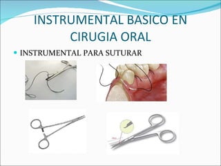 INSTRUMENTAL BASICO EN CIRUGIA ORAL INSTRUMENTAL PARA SUTURAR 