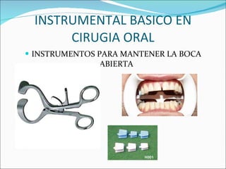INSTRUMENTAL BASICO EN CIRUGIA ORAL INSTRUMENTOS PARA MANTENER LA BOCA ABIERTA 