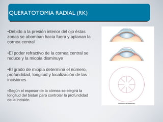 QUERATOTOMIA RADIAL (RK)
•Debido a la presión interior del ojo éstas
zonas se abomban hacia fuera y aplanan la
cornea central
•El poder refractivo de la cornea central se
reduce y la miopía disminuye
•El grado de miopía determina el número,
profundidad, longitud y localización de las
incisiones
Según el espesor de la córnea se elegirá la
longitud del bisturí para controlar la profundidad
de la incisión.
 