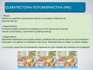 QUERATECTOMIA FOTORREFRACTIVA (PRK)
• Miopía
Aplana la superfice corneal para reducir la curvatura y disminuir la
potencia del ojo
• Hipermetropía
Se elimina tejido corneal en la periferia con el fín de curvar la cornea
central (zona óptica) y aumentar la potencia del ojo
• Astigmatismo
Diferentes ablaciones en al parte central y periferica de la córnea para curvar el meridiano
más plano y el aplanar el meridiano más curvo. Generalmente se utiliza un patrón elíptico
• La función visual tras la intervención depende en gran medida del centrado de la ablación
 