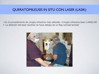 QUERATOMILEUSIS IN SITU CON LASER (LASIK)
• Es el procedimiento de cirugía refractiva más utilizado • Cirugía refractiva laser LAMELAR
La ablación del laser excimer se hace debajo de un flap corneal lamelar
 