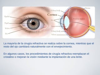 La mayoría de la cirugía refractiva se realiza sobre la cornea, mientras que el
resto del ojo cambiará naturalmente con el envejecimiento.
En algunos casos, los procedimientos de cirugía refractiva reemplazan el
cristalino o mejoran la visión mediante la implantación de una lente.
 