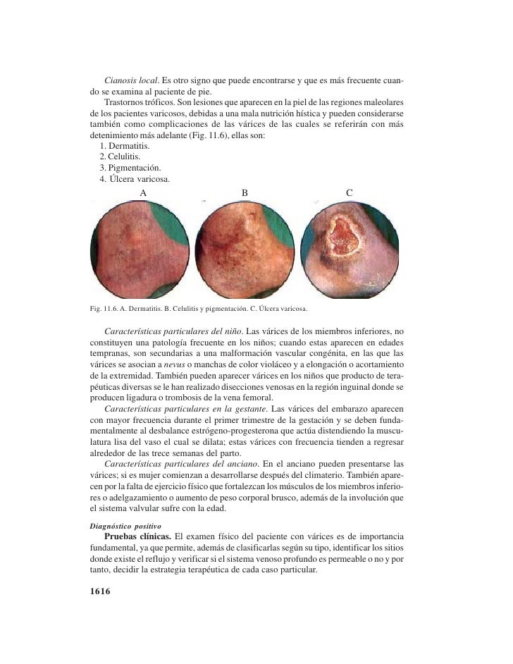La mejor crema para el crecimiento del miembro