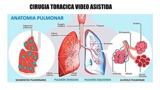 CIRUGIA TORACICA VIDEO ASISTIDA
ANATOMIA PULMONAR
 