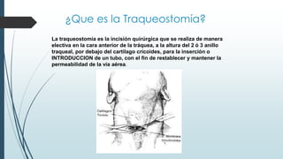 Material y Equipo para realizar
la Traqueostomia….
 