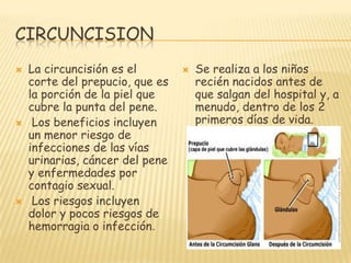 CIRCUNCISION
   La circuncisión es el           Se realiza a los niños
    corte del prepucio, que es       recién nacid...
