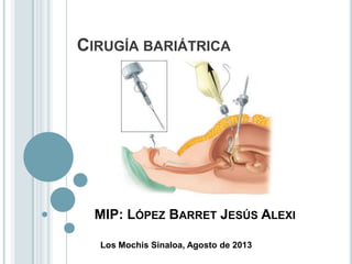 CIRUGÍA BARIÁTRICA

MIP: LÓPEZ BARRET JESÚS ALEXI
Los Mochis Sinaloa, Agosto de 2013

 