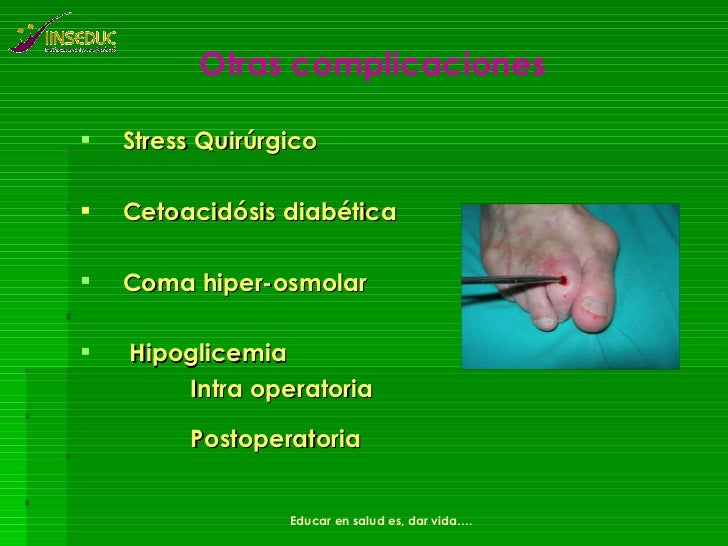 Diabetes y Cirugia Diabetes y Cirugia