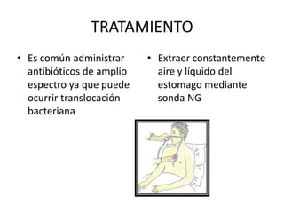 TRATAMIENTO
• Es común administrar
antibióticos de amplio
espectro ya que puede
ocurrir translocación
bacteriana

• Extraer constantemente
aire y líquido del
estomago mediante
sonda NG

 