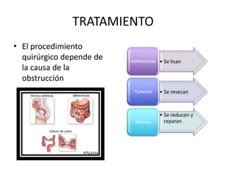 TRATAMIENTO
• El procedimiento
quirúrgico depende de
la causa de la
obstrucción

Adherencias • Se lisan

Tumores

• Se resecan

Hernias

• Se reducen y
reparan

 