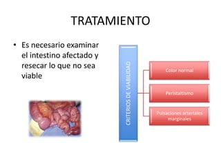 • Es necesario examinar
el intestino afectado y
resecar lo que no sea
viable

CRITERIOS DE VIABILIDAD

TRATAMIENTO

Color normal

Peristaltismo

Pulsaciones arteriales
marginales

 
