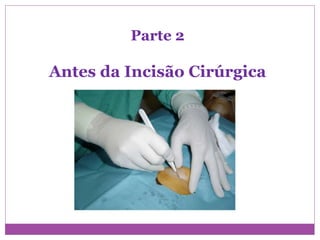 Parte 2
Antes da Incisão Cirúrgica
 