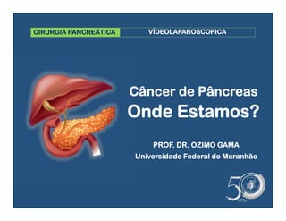 CIRURGIA PANCREÁTICA
Câncer de Pâncreas
Onde Estamos?
VÍDEOLAPAROSCOPICA
PROF. DR. OZIMO GAMA
Universidade Federal do Maranhão
 