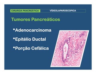 Cirurgia Laparoscópica no Adenocarcinoma de Pâncreas