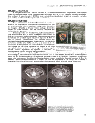 Arlindo Ugulino Netto – CIRURGIA ABDOMINAL– MEDICINA P7 – 2010.2
105
ESTUDOS LABORATORIAIS
A contagem de leucócitos é elevada, com mais de 75% de neutrófilos na maioria dos pacientes. Uma contagem
de leucócitos completamente normal e diferencial é encontrada em cerca de 10% dos pacientes com apendicite aguda.
Uma contagem de leucócitos alta (> 20000/ml) sugere apendicite complicada com gangrena e perfuração. A urinálise
pode também ser útil na exclusão da pielonefrite ou nefrolitíase.
ESTUDOS RADIOLÓGICOS
O uso indiscriminado de radiografia simples de abdome na
avaliação dos pacientes com dor abdominal aguda é injustificado, pois
em raríssimos casos, sugerem ou alteram o diagnóstico. Elas podem
ser uteis para a detecção de cálculos ureterais, obstrução do intestino
delgado ou úlcera perfurada, mas tais condições raramente são
confundidas com apendicite.
Entre os pacientes com dor abdominal, a ultrassonografia tem
uma sensibilidade de cerca de 85% e uma especificidade de mais de
90% para o diagnóstico de apendicite aguda. Os achados sonográficos
compatíveis com apendicite aguda incluem um apêndice de 7mm ou
mais no diâmetro ântero-posterior, uma estrutura luminal não
compreensível e de parede espessada vista em secção cruzada, sendo
comumente referida como lesão em alvo, ou a presença de um
apendicolito. A ultrassonografia tem vantagens de ser uma modalidade
não invasiva que não exige preparação do paciente e que evita
exposição à radiação ionizante. As desvantagens da ultrassonografia
incluem acurácia dependente do operador e dificuldade na
interpretação das imagens por outros que não o operador.
A tomografia computadorizada (TC) é comumente usada na avaliação de pacientes adultos com suspeita de
apendicite aguda. Técnicas melhoradas de imagem, incluindo o uso de cortes de 5mm, têm resultado em maior acurácia
da TC, que tem uma sensibilidade de cerca de 90% e uma especificidade de 80 a 90% para o diagnóstico de apendicite
aguda entre pacientes com dor abdominal. Achados clássicos incluem um apêndice distendido com mais de 7mm de
diâmetro e espessamento circunferencial da parede, que pode dar a aparência de um halo ou alvo. Conforme a
inflamação evolui, pode-se ver gordura periapendicular retorcida, edema, líquido peritoneal, fleimão ou abscesso.
 