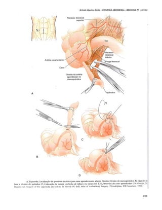 Arlindo Ugulino Netto – CIRURGIA ABDOMINAL– MEDICINA P7 – 2010.2
108
 