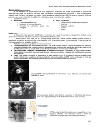 Arlindo Ugulino Netto – CIRURGIA ABDOMINAL– MEDICINA P7 – 2010.2
117
QUADRO CL…NICO
A SM determina um quadro clínico de difícil diagnóstico. Na maioria das vezes, os pacientes se queixam de
crises de cólica biliar por repetição, de longa data. Geralmente, os pacientes têm história de 10 anos de cálculos de
vesícula biliar. Portanto, não existe um quadro clínico-laboratorial específico para SM. No entanto, cerca de 80% dos
pacientes apresentam: icterícia, dor abdominal e alterações das provas de função hepática.
Desta forma, temos:
 Anamnese:
 Colelitíase de longa data
 Episódios de icterícia obstrutiva
 Passado de colecistite aguda e/ou
colangite
 Sinais e sintomas:
 Dor abdominal em HCD e/ou epigástrio
 Icterícia
 Náuseas e vômitos
 Colúria
 Febre
DIAGN†STICO
O diagnóstico intra-operatório da SM ocorre na maioria das vezes. O diagnóstico pré-operatório é difícil, sendo
necessário um elevado índice de suspeita para evitar lesões da árvore biliar.
O exame padrão ouro para SM é a colangio-RNM. Além dela, outros exames também podem fornecer o
diagnóstico ao médico: a colangiografia intra-operatória, USG de abdome (sugere o diagnóstico) e TC de abdome são
exames que podem ser utilizados também.
Portanto, para o seu diagnóstico, podemos lançar mão:
 Colangioressonância: é o exame padrão-ouro para a SM, sendo o exame mais útil. Ela pode demonstrar com precisão a
presença de dilatação biliar, o grau de obstrução, a localização intra ou extra luminal dos cálculos, identificar e avaliar o grau
de inflamação ao redor da vesícula. Pode revelar alterações anatômicas como fístulas e mal-formações.
 Ultra-sonografia e Tomografia Computadorizada de Abdome: Podem sugerir o diagnóstico de SM ao revelar cálculo(s)
fixo(s) na área do infundíbulo, próximo à junção do ducto cístico com o colédoco, e dilatação das vias biliares acima do local
da compressão.
 CPRE: Pode revelar compressão ou estreitamento do ducto hepático comum. É um método que tem a vantagem de ser
também utilizado como terapêutico. Além da remoção dos cálculos da via biliar, a CPRE permite a colocação de stents que
servem para drenagem das vias biliares e identificação do ducto biliar comum durante ato operatório.
Colangio-RNM evidenciando falha de enchimento na via biliar de um paciente com
síndrome de Mirizzi.
Ultrassonografia do trato biliar. Cálculo impactado no infundíbulo da vesícula
biliar (seta larga) e dilatação do ducto hepático comum (seta pequena).
CPRE mostrando ducto hepático comum e vias biliares intra-
hepáticas dilatadas com colédoco normal e defeito de
enchimento na junção do ducto cístico com colédoco.
 