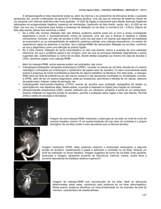 Arlindo Ugulino Netto – CIRURGIA ABDOMINAL– MEDICINA P7 – 2010.2
137
A ultrassonografia ‚ mais importante ainda se, al‚m da icter„cia e do predom„nio de bilirrubina direta, o paciente
apresentar dor, prurido e altera€‰es da gama-GT e fosfatase alcalina, uma vez que as chances de estarmos diante de
um paciente com icter„cia obstrutiva s•o muito grandes. A USG de f„gado ‚ importante para afastar doen€as hep†ticas
(altera€‰es na ecogenicidade hep†tica, presen€a de nodula€‰es, hipertrofia de lobo direito, ascite, etc.). A USG de via
biliar, por sua vez, ‚ importante para avaliar a presen€a de dilata€•o na via biliar (o normal ‚ 0,6 – 0,9cm). Depois de
feito este exame, temos dois caminhos a trilhar:
 Se a USG n•o mostrar dilata€•o das vias biliares, podemos realizar parar por a„ com a nossa investiga€•o
diagn‡stica e iniciar o acompanhamento cl„nico do paciente, uma vez que a doen€a ‚ hep†tica e tratada
clinicamente. Contudo, em caso de dŠvidas ‹ USG (uma vez que este ‚ um exame que depende da habilidade
do examinador) ou na impossibilidade de realiz†-la, podemos solicitar uma colangio-resson…ncia, um exame de
resson…ncia capaz de desenhar a via biliar. Se a colangio-RNM n•o demonstrar dilata€•o da via biliar, confirma-
se que o diagn‡stico como uma afec€•o do pr‡prio f„gado.
 Se a USG mostrar dilata€•o do ducto intra-hep†tico ou das vias biliares, temos a suspeita de uma colestase
obstrutiva, em que o problema passa a ser cirŠrgico, uma vez que as principais hip‡teses diagn‡sticas a serem
sugeridas s•o: coledocolit„ase ou tumor de via biliar. Diante destas suspeitas (ou mesmo em caso de dŠvidas ‹
USG), devemos sugerir uma colangio-RNM.
Al‚m da colangio-RNM, outros exames podem ser solicitados, tais como:
 Colangiopancreatografia retr‡grada endosc‡pica (CPRE): consiste no estudo da via biliar atrav‚s de um exame
radiol‡gico contrastado por endoscopia e cateterismo da papila maior do duodeno. O maior inconveniente deste
exame ‚ presen€a de morbi-mortalidade j† descrita em alguns trabalhos na literatura. Por esta raz•o, a colangio-
RNM deve ser feita de preferƒncia por ser menos invasivo e n•o apresentar morbidade ou mortalidade; contudo,
a CPRE, al‚m de ser um exame diagn‡stico, pode ser terapƒutico, permitindo a retirada de um c†lculo, abertura
da papila maior, bi‡psia, coleta de secre€•o, etc.
 Colangiografia trans-parieto-hep†tica (CTPH): exame de escolha para avalia€•o radiogr†fica de les‰es ou
obstru€‰es em vias hep†ticas altas. Neste exame, a pun€•o ‚ realizada no f„gado para inje€•o do contraste.
 Ultrassonografia endosc‡pica (USE): exame realizado por um ultrassom acoplado ‹ ponta de um endosc‡pio.
Quando instalado na segunda por€•o do duodeno, permite a avalia€•o desta regi•o e das vias biliares. Permite
ainda a coleta de secre€•o e de bi‡psia.
Imagem de uma colangio-RNM mostrando a obstru€•o da via biliar ao n„vel do in„cio do
conduto hep†tico comum. ˆ um exame bastante Štil cujo meio de contraste ‚ o pr‡prio
hidrogƒnio da via biliar (onde ‚ mais abundante que os demais tecidos).
Imagem mostrando CPRE. Nela, podemos observar o endosc‡pio alcan€ando a segunda
por€•o do duodeno, cateterizando a papila e aplicando o contraste na via biliar. Nota-se um
sinal de subtra€•o no ducto hep†tico, imagem sugestiva de tumor de via biliar. Este paciente,
associada a imagem, apresenta aumento de bilirrubuna, icter„cia, colŠria, acolia fecal e
aumento laboratorial de fosfatase alcalina e gama-GT.
Imagem de colangio-RNM com reconstru€•o de via biliar. Note as estruturas
determinadas pelas setas, mostrando toda anatomia da via biliar extra-hep†tica.
Neste exame, podemos identificar um sinal arredondado na via chamado de sinal do
menisco, caracter„stico de coledocolit„ase.
 