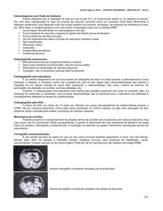 Arlindo Ugulino Netto – CIRURGIA ABDOMINAL– MEDICINA P7 – 2010.2
141
Colecistograma oral (Teste de Graham).
Exame realizado com a utilização de iodo em que se dá 10 a 12 comprimidos deste íon na véspera do exame.
Há, com isso, impregnação do iodo na mucosa da vesícula, servindo como um contraste. Este teste dificilmente é
realizado atualmente, pois depende muito da função hepática do paciente, da bexiga, da presença de intolerância a iodo,
etc. Além disso, a imagem gerada é ruim, sem haver comparação justa com a colangio-RNM.
As principais características do colecistograma oral são:
 Funcionamento da vesícula e resposta à ingesta de lipídios (prova de Boyden).
 Pouca nitidez da via biliar principal
 Uso de medicamentos altera a função da vesícula e mascara o teste
 Não opacificação
 Obstrução cística
 Colecistite
 Incapacidade de eliminar
 Problemas técnicos
Colangiografia endovenosa.
 Bilirrubinemia acima de 3mgdl contraindica o exame
 Serve para avaliação da árvore biliar, mas tem pouca nitidez
 Dificuldade na visualização de cálculos pequenos
 Vantagem: não é necessária vesícula biliar funcionante
Colangiografia intra-operatória.
É um artifício diagnóstico em que se procede da radiografia de toda a via biliar durante a colecistectomia. A sua
indicação é seletiva, e somente ocorre nas ocasiões em que se tem algum fator clínico-laboratorial que aponte a
migração de um cálculo através do canal biliar (causando a coledocolitíase), tais como: história de icterícia, de
pancreatite, de alteração na via biliar, enzimas alteradas, etc.
Portanto, a colangiografia intra-operatória está restrita para aqueles pacientes dos quais se suspeita, além da
presença de colecistite ou colelitíase, uma eventual coledocolitíase. Isto é importante pois o tratamento da colelitíase é
completamente diferente da terapia da coledocolitíase.
Colangiografia pelo Kehr.
O dreno de Kehr (ou dreno em T) pode ser utilizado nos casos pós-operatórios de coledocolitíase quando a
CPRE não se mostrava disponível. Como este dreno apresenta um orifício exposto na pele para drenagem da bile,
podemos injetar contraste para avaliar a presença de cálculos residuais.
Manometria da via biliar.
Podemos observar o comportamento da pressão dentro da via biliar de um paciente com icterícia obstrutiva, mas
cuja causa não foi encontrada. Muito provavelmente, o quadro é decorrente de uma hipertonia da abertura da papila
maior do duodeno, dificultando a saída da bile. A contração do esfíncter da papila é facilmente reconhecida através da
manometria.
Tomografia computadorizada.
É um exame útil para os casos em que se tem como principal hipótese diagnóstica o tumor nas vias biliares.
Através dela, além de calcular a extensão tumoral, podemos procurar pela presença de metástases, ascite,
carcinomatose, invasão vascular ou de outros órgãos. Pode ser útil em serviços que não dispõem de colagio-RNM.
Exame tomográfico mostrando neoplasia de vesícula biliar.
Exame tomográfico mostrando neoplasia da cabeça do pâncreas.
 