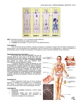 Arlindo Ugulino Netto – CIRURGIA ABDOMINAL– MEDICINA P7 – 2010.2
157
OBS
7
: Associado aos tipos I, II, III, IV podemos ainda evidenciar:
 E: Comprometimento de órgãos extra-nodais
 X (bulky): Se tumoração > 10 cm ou com 1/3 do diâmetro torácico
TRATAMENTO
Para os linfomas do tipo ocidental, a terapia de eleição é a ressecção cirúrgica. Para as lesões irressecáveis, a
terapia passa a ser quimioterapia e/ou radioterapia. Para os linfomas do tipo mediterrâneo, a terapia de eleição é a
quimioterapia, sendo a cirurgia uma indicação nas situações em que a doença é localizada (muito raramente).
TUMOR NEUROEND†CRINO CARCINOIDE
É um tumor raro, com bom prognóstico. Sua taxa de
sobrevida global em cinco anos é de até 50%. Com uma
predominância no íleo distal e apêndice, apresentando metástases
em tumores maiores do que 2 cm (90%). A síndrome carcinóide
está presente em apenas 10%, pois, depende, quase
exclusivamente, da lesão metastática do fígado.
A síndrome carcinoide é produto da liberação de uma
grande quantidade de substâncias vasoativas (como a histamina e
a serotonina) na circulação sistêmica. Os sintomas aparecem
quando os tumores estão maiores ou com metástases (hepáticas,
principalmente). Os tumores carcinoides com menos de 1cm
raramente causam metástase e síndrome carcinoide. O quadro
clínico é representado por manifestações causadas pela produção
e excreção repentina de aminas vasoativas em nível sistêmico,
causando: rubor facial, broncoespasmo, diarreia, dor abdominal e
taquicardia.
DIAGNÓSTICO
Para o diagnóstico deste tipo de tumor, devemos
requisitar a dosagem da cromogranina A e sinaptofisina.
Além destes, a cintilografia também pode ser requisitada
em casos de dúvidas sobre outras implantações tumorais.
TRATAMENTO
 Ressecção cirúrgica representa a melhor opção
terapêutica.
 Tratamento clínico para casos avançados e
sintomáticos: antagonista dos inibidores de
serotonina (análogos da somatostatina).
 