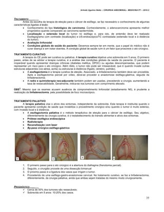 Arlindo Ugulino Netto – CIRURGIA ABDOMINAL– MEDICINA P7 – 2010.2
35
TRATAMENTO _____
Antes da escolha da terapia de eleição para o câncer de esôfago, se faz necessário o conhecimento de algumas
características ligadas à lesão:
 Conhecimento do tipo histológico do carcinoma. Conhecidamente, o adenocarcinoma apresenta melhor
prognóstico quando comparado ao carcinoma epidermóide.
 Localização e extensão local do tumor no esôfago e, para isto, de antemão deve ter realizado
Esofagograma com contraste (localização) e US-endoscópico/TC contrastada (extensão local e à distância
do tumor).
 Avaliação linfonodal
 Condições globais de saúde do paciente: Devemos sempre ter em mente, que o papel do médico não é
curar doença e sim tratar doentes. A condição global de saúde ruim é um fator que proscreve o ato cirúrgico.
TRATAMENTO CURATIVO
A terapia do CE pode ser curativa ou paliativa. A terapia curativa objetiva uma sobrevida em 5 anos. O primeiro
passo, antes de se adotar a terapia curativa, é a análise das condições globais da saúde do paciente. O paciente é
inoperável quando apresentar doenças crônicas (diabetes mellitus, DPOC) ou agudas descompensadas, que podem
representar um risco para o ato cirúrgico. Além disto, o tumor não pode ser irressecável, que é quando invade outras
estruturas adjacentes (via aérea, aorta) ou estruturas à distância (fígado, cérebro, pulmão).
 A esofagectomia é a terapia curativa de eleição. Associado, a linfadenectomia também deve ser procedida.
Após a esofagectomia parcial por vídeo, deve-se proceder a anastomose esôfago-gástrica, seguida da
linfadenectomia.
 A radio e quimioterapia neo-adjuvante também podem ser usadas, precedendo a cirurgia, aumentando a
taxa de ressecabilidade. Geralmente, indica-se nos tumores com comprimento elevado.
OBS
2
: Mesmo que os exames acusem ausência de comprometimento linfonodal (estadiamento N0), é prudente a
realização da linfadenectomia, pela possibilidade de foco microscópico.
TRATAMENTO PALIATIVO
A terapia paliativa visa o alívio dos sintomas, independente da sobrevida. Esta terapia é instituída quando o
paciente apresenta condição de saúde que inviabiliza o procedimento cirúrgico e/ou quando o tumor é muito extenso,
com invasão local e à distância.
 A esofagectomia paliativa é o método terapêutico de eleição para o câncer de esôfago. Seu objetivo,
diferentemente da cirurgia curativa, é o restabelecimento do transito alimentar e alivio dos sintomas.
 Prótese esofágica endoscópica
 Radioterapia
 Recanalização com laser
 By-pass cirúrgico esôfago-gástrico
1. O primeiro passo para o ato cirúrgico é a abertura do diafragma (frenotomia parcial).
2. Seguido, o cirurgião procede de uma dissecção bimanual
3. O próximo passo é a ligadura dos vasos que irrigam o tumor.
4. Procedendo de uma esôfago-gastro-anastomose cervical. No tratamento curativo, se faz a linfadenectomia,
diferentemente, da cirurgia paliativa, ainda que ambas sejam tratadas do mesmo modo cirurgicamente.
PROGN†STICO _____
 Cerca de 50% dos tumores são ressecáveis;
 Sobrevida em 5 anos: 10-20% dos casos.
 