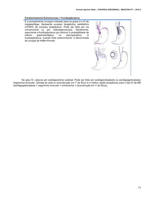 Arlindo Ugulino Netto – CIRURGIA ABDOMINAL– MEDICINA P7 – 2010.2
51
Cardiomiotomia Extramucosa + Fundoaplicatura
É o procedimento cirúrgico indicado para os graus II e III de
megaesôfago. Apresenta sucesso terapêutico satisfatório
(70-90% de sucesso terapêutico). Pode ser feita por via
convencional ou por videolaparoscopia. Geralmente,
associa-se a fundoaplicatura por diminuir a probabilidade de
refluxo gastroesofágico no pós-operatório. A
fundoaplicatura, quando feita anteriormente, é denominada
de cirurgia de Heller-Pinnotti.
No grau IV, opta-se por esofagectomia subtotal. Pode ser feita por esofagocoloplastia ou esofagogastroplasia.
Vagotomia troncular, retirada do antro e reconstrução em Y de Roux é a melhor opção terapêutica para o tipo IV de ME
(esofagogastroplasia + vagotomia troncular + antrectomia + reconstrução em Y de Roux).
 