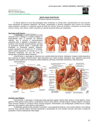 Arlindo Ugulino Netto – CIRURGIA ABDOMINAL– MEDICINA P7 – 2010.2
62
MED RESUMOS 2012
NETTO, Arlindo Ugulino.
CIRURGIA ABDOMINAL _________
NEOPLASIAS GÁSTRICAS
(Professor Marcelo Gonçalves)
O c…ncer g†strico ‚ uma das patologias mais incidentes no mundo todo, representando um dos tumores
mais frequentes do aparelho digest‡rio. No Brasil, representam a terceira neoplasia mais comum em homens
(ap‡s pr‡stata e pulm•o) e a segunda causa de ‡bito por c…ncer. Entre as mulheres, constituem na quinta mais
comum (mama, colo uterino, c‡lon e pulm•o) e a quarta causa de ‡bitos por neoplasias.
ANATOMIA DO ESTƒMAGO
O estômago ‚ a parte expandida do trato
alimentar entre o esŒfago e o intestino delgado. ˆ
especializado para o acŠmulo de alimento
ingerida, que ‚ qu„mica e mecanicamente
preparado para a digest•o e passagem para o
duodeno. Com exce€•o da parte pil‡rica, que est†
no quadrante superior direito, o estŒmago est†
localizado no quadrante superior esquerdo,
quando apresenta um formato em “C” invertido,
por‚m quando apresenta um formato em “J” em
indiv„duos longil„neos, em que ele pode se
alongar at‚ o quadrante inferior esquerdo.
Anteriormente, o estomago se relaciona com: parede abdominal anterior, diafragma, margem costal esquerda e
lobo esquerdo do f„gado. Posteriormente, est† relacionado com: bolsa omental, diafragma, ba€o, gl…ndula supra-renal
esquerda, parte superior do rim esquerdo, art‚ria esplƒnica, p…ncreas, mesoc‡lon transverso e colo transverso.
DIVISÃO ANATÔMICA
Externamente, o estomago ‚ configurado pelas seguintes regi‰es: C†rdia (‡stio c†rdico), Fundo g†strico, Corpo
g†strico, Parte pil‡rica (antro pil‡rico, canal pil‡rico, piloro e ‡stio pil‡rico), Parede anterior, Parede posterior, Curvatura
maior (incisura c†rdica) e Curvatura menor (incisura angular). Internamente, sua configura€•o constitui-se em: pregas
g†stricas, sulco g†strico, ‡stio c†rdico e ‡stio pil‡rico.
O estŒmago apresenta trƒs camadas musculares: uma longitudinal (externa), uma circular (m‚dia) e uma obliqua
(interna). Essa camada obliqua adicional representa a necessidade de uma camada muscular extra para a fun€•o de
propuls•o e mistura realizada por esse ‡rg•o.
 