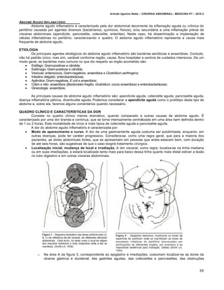 Arlindo Ugulino Netto – CIRURGIA ABDOMINAL– MEDICINA P7 – 2010.2
88
ABDOME AGUDO INFLAMAT†RIO
Abdome agudo inflamatório é caracterizado pela dor abdominal decorrente da inflamação aguda ou crônica do
peritônio causada por agentes diversos (bacterianos, químicos, físicos), e/ou secundária a uma inflamação prévia de
vísceras abdominais (apendicite, pancreatite, colecistite, enterites). Neste caso, há disseminação e implantação de
células inflamatórias no peritônio, caracterizando o quadro. O abdome agudo inflamatório representa a causa mais
frequente de abdome agudo.
ETIOLOGIA
Os principais agentes etiológicos do abdome agudo inflamatório são bactérias aeróbicas e anaeróbias. Contudo,
não há padrão único, mas sim, variável conforme região, causa, flora hospitalar e centros de cuidados intensivos. De um
modo geral, as bactérias mais comuns no que diz respeito ao órgão acometido são:
 Esôfago: Gram-positivas e cândida;
 Estômago: Gram-positivas e cândida;
 Vesícula: enterococos, Gram-negativos, anaeróbios e Clostridium perfringens;
 Intestino delgado: enterobacteriáceas;
 Apêndice: Gram-negativas, E.coli e anaeróbios;
 Cólon e reto: anaeróbios (Bacteroides fragilis, clostridium, cocos anaeróbios) e enterobacteriáceas;
 Ginecologia: anaeróbios.
As principais causas de abdome agudo inflamatório são: apendicite aguda, colecistite aguda, pancreatite aguda,
doença inflamatória pélvica, diverticulite aguda. Podemos considerar a apendicite aguda como o protótipo deste tipo de
abdome e, sobre ela, faremos alguns comentários quando necessário.
QUADRO CLÍNICO E CARACTERÍSTICAS DA DOR
Consiste no quadro clínico menos dramático, quando comparado a outras causas de abdome agudo. É
caracterizado por uma dor branda e contínua, que se torna intensamente centralizada em uma área bem definida dentro
de 1 ou 2 horas. Esta modalidade de início é mais típica de colecistite aguda e pancreatite aguda.
A dor do abdome agudo inflamatório é caracterizada por:
 Modo de aparecimento e curso. A dor de uma gastroenterite aguda costuma ser autolimitada, enquanto, em
outras doenças, pode ter caráter progressivo. Considera-se, como uma regra geral, que para a maioria dos
pacientes, as dores abdominais fortes, que se apresentam em pessoas que antes estavam bem, com duração
de até seis horas, são sugestivas de que o caso exigirá tratamento cirúrgico.
 Localização inicial, mudança de local e irradiação. A dor visceral, como regra, localiza-se na linha mediana
ou em suas imediações, e estará localizada tanto mais para baixo dessa linha quanto mais distal estiver a lesão
no tubo digestivo e em outras vísceras abdominais.
o Na área A da figura 3, correspondente ao epigástrio e imediações, costumam localizar-se as dores da
úlceras gástrica e duodenal, das gastrites agudas, das colecistites e pancreatites, das obstruções
 