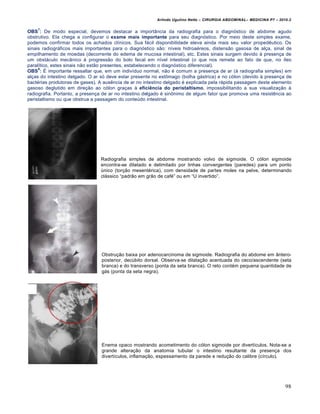 Arlindo Ugulino Netto – CIRURGIA ABDOMINAL– MEDICINA P7 – 2010.2
98
OBS
7
: De modo especial, devemos destacar a import…ncia da radiografia para o diagn‡stico de abdome agudo
obstrutivo. Ela chega a configurar o exame mais importante para seu diagn‡stico. Por meio deste simples exame,
podemos confirmar todos os achados cl„nicos. Sua f†cil disponibilidade eleva ainda mais seu valor propedƒutico. Os
sinais radiogr†ficos mais importantes para o diagn‡stico s•o: n„veis hidroa‚reos, distens•o gasosa de al€a, sinal de
empilhamento de moedas (decorrente do edema de mucosa intestinal), etc. Estes sinais surgem devido ‹ presen€a de
um obst†culo mec…nico ‹ progress•o do bolo fecal em n„vel intestinal (o que nos remete ao fato de que, no „leo
paral„tico, estes sinais n•o est•o presentes, estabelecendo o diagn‡stico diferencial).
OBS
8
: ˆ importante ressaltar que, em um indiv„duo normal, n•o ‚ comum a presen€a de ar (‹ radiografia simples) em
al€as do intestino delgado. O ar s‡ deve estar presente no estŒmago (bolha g†strica) e no c‡lon (devido ‹ presen€a de
bact‚rias produtoras de gases). A ausƒncia de ar no intestino delgado ‚ explicada pela r†pida passagem deste elemento
gasoso deglutido em dire€•o ao c‡lon gra€as ‹ eficiência do peristaltismo, impossibilitando a sua visualiza€•o ‹
radiografia. Portanto, a presen€a de ar no intestino delgado ‚ sinŒnimo de algum fator que promova uma resistƒncia ao
peristaltismo ou que obstrua a passagem do conteŠdo intestinal.
Radiografia simples de abdome mostrando volvo de sigmoide. O c‡lon sigmoide
encontra-se dilatado e delimitado por linhas convergentes (paredes) para um ponto
Šnico (tor€•o mesent‚rica), com densidade de partes moles na pelve, determinando
cl†ssico “padr•o em gr•o de caf‚” ou em “U invertido”.
Obstru€•o baixa por adenocarcinoma de sigmoide. Radiografia do abdome em …ntero-
posterior, decŠbito dorsal. Observa-se dilata€•o acentuada do ceco/ascendente (seta
branca) e do transverso (ponta da seta branca). O reto cont‚m pequena quantidade de
g†s (ponta da seta negra).
Enema opaco mostrando acometimento do c‡lon sigmoide por divert„culos. Nota-se a
grande altera€•o da anatomia tubular o intestino resultante da presen€a dos
divert„culos, inflama€•o, espessamento da parede e redu€•o do calibre (c„rculo).
 