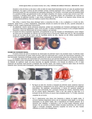 Arlindo Ugulino Netto; Luiz Gustavo Correia; Yuri L. Eloy – CIRURGIA DE CABE•A E PESCO•O – MEDICINA P6 – 2010.1
10
levantar a rima da boca ou de ocluir o olho no lado do nervo facial lesionado (se for um caso de paralisia facial
periférica). As rugas e sulcos da face também somem. Embora apareçam com o mesmo sinal clínico, estes
pacientes podem ter sido acometidos por patologias diferentes. Em homens, a principal causa de paralisia facial
é a paralisia de Bell, que geralmente é viral, de origem idiopática. Em idosos, a causa mais comum é por AVC,
causando a paralisia facial central. Contudo, ambos os pacientes podem ser acometidos por tumores ou
nodulações na glândula parótida, o que causa compressão do nervo facial e os mesmos sinais clínicos da
paralisia facial periférica, mas com história e exame físico diferentes.
Nos olhos, o exame físico deve abranger tanto a conjuntiva do olho, a íris, a pálpebra e o fundo de olho,
avaliando, desta forma, a retina. Papiledema, pesquisado através do exame de fundo de olho, quando associado à
cefaléia e vômito, sugere hipertensão intracraniana.
 As pálpebras, mesmo sendo estruturas pequenas, podem ser acometidas por inúmeras patologias tais como
processos infecciosos palpebrais, cistos, tumor de pele. O calázio (hordéolo ou terçol) é uma condição bastante
frequente, e deve ser diferenciado de tumores malignos, por exemplo.
 O exame da retina é bastante importante, principalmente no que diz respeito ao retinoblastoma, tumor maligno
de retina que se manifesta na infância cujo principal sinal é a leucocoria. Neste caso (em D), não há proptose
ocular por se tratar de um tumor que se manifesta dentro do olho. Apenas se ele infiltrar posteriormente,
invadindo a órbita, poderá causar a proptose.
EXAME DA CAVIDADE NASAL
O exame clínico do nariz é constituído da observação da pirâmide nasal e da cavidade nasal. A pirâmide nasal,
estrutura mais proeminente do andar médio da face, pode ser examinada sem o auxílio de instrumentos, bastando uma
boa iluminação. Apresenta morfologia variada, geralmente em razão de características raciais e/ou de traumas sofridos.
A cavidade nasal deve ser examinada com uma fonte de luz que permita trabalhar com as mãos livres (espelho
frontal e/ou fotóforo) para manipulação da mesma. O instrumental básico da rinoscopia anterior é constituído do espelho
de Glatzell, do espéculo nasal, da pinça baioneta, do algodão laminado e da solução de efedrina a 2%. A visão
especular da cavidade nasal permite a avaliação das conchas nasais, dos meatos e parte do septo nasal, de maneira
bastante clara. Durante esta investigação, deve-se procurar por indícios de tumorações.
 Na figura ao lado (E), durante a inspeção da pirâmide nasal, podemos observar
uma hiperemia e alargamento da narina, talvez por enrijecimento da cartilagem
subcutânea. Na palpação, provavelmente, a narina do paciente poderá se
mostrar mais endurecida. Se o processo doloroso for intenso, estaremos diante
de um quadro agudo inflamatório. Caso a dor não exista ou seja leve, e a
evolução de deu de forma um pouco mais arrastada (entre 7 a 15 dias), devemos
suspeitar de um tumor.
 Em F, observamos uma idosa com hiperemia e edema na região malar. A
primeira hipótese diagnóstica seria a de um abscesso nesta região, ou de seios
paranasais ou de partes moles. Daí a importância da história pessoal: se a
paciente tiver diabetes, a hiperemia e dor no local sugere abscesso quase
sempre. Se, ao contrário, a história relatar sinusites recorrentes, dor crônica na
região e evolução arrastada, devemos suspeitar de tumor de seio maxilar
infiltrativo ou tumor com infecção local.
 