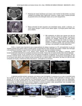 Arlindo Ugulino Netto; Luiz Gustavo Correia; Yuri L. Eloy – CIRURGIA DE CABE•A E PESCO•O – MEDICINA P6 – 2010.1
16
 Presen•a de massa hipodensa que ocupa o seio maxilar do lado direito e as duas
metades da cavidade nasal, destruindo, inclusive, o septo nasal. A queixa principal
do paciente seria uma obstru•‚o nasal, com ou sem sangramento.
 Massa etmoidal do lado esquerdo com densidade ƒssea, sendo o osteoma, um
tumor ƒsseo benigno, o mais comum dessa regi‚o. A principal queixa neste caso
seria cefal€ia.
 RM mostrando um bƒcio que cresceu por tr‡s da
traqu€ia, ficando † frente do es‹fago. A queixa do
paciente era disfagia. Optou-se por este exame
para melhor visualiza•‚o dos limites da massa da
tireƒide. Contudo, o melhor exame para avaliar a
tireƒide € a ultrassonografia, mas que seria incapaz
de tra•ar, com precis‚o, os limites deste bƒcio.
Enfim, o exame mais importante para a especialidade de cabe•a e pesco•o € a TC, principalmente no que diz
respeito † janela para partes moles ou janela ƒssea. A resson…ncia € mais utilizada para avaliar o estado das meninges
e do parˆnquima cerebral ou para fornecer melhores detalhes para algumas condutas cirŠrgicas.
A ultrassonografia (US) € um exame muito utilizado na especialidade de cabe•a e pesco•o, sendo
fundamentalmente importante na avalia•‚o da textura da tireƒide. Trata-se de um exame barato e f‡cil de ser realizado.
A tireƒide normal, na US, mostra-se com uma textura homogˆnea. A presen•a de um nƒdulo na tireƒide, como o
exemplo mostrado abaixo, demonstra-se como uma altera•‚o na textura da gl…ndula, mostrando-se hipoecogˆnico, isto
€, um pouco mais escuro que a textura normal, provando ser um nƒdulo sƒlido, mais denso. Se fosse um caso de cisto
composto por l„quido, mostrava-se ainda mais escuro – anecogˆnico ou anecƒico.
A gl…ndula parƒtida tamb€m apresenta uma textura mais homogˆnea. A presen•a de um cisto na parƒtida pode
ser revelado na US como uma massa anecogˆnica. Grande parte dos nƒdulos nestas gl…ndulas € benigna, mas €
atrav€s da US que se pode determinar as caracter„sticas do nƒdulo e sugerir um poss„vel grau de malignidade.
Geralmente, os cistos apresentam-se com refor•o acŠstico posterior. A propriedade do Doppler que a US disponibiliza
pode auxiliar na diferencia•‚o entre tumores malignos e tumores benignos: estes apresentar‚o uma circula•‚o mais
perif€rica, enquanto os tumores malignos apresentam circula•‚o central.
 