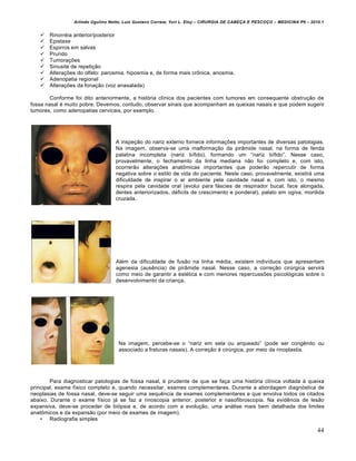 Arlindo Ugulino Netto; Luiz Gustavo Correia; Yuri L. Eloy – CIRURGIA DE CABE•A E PESCO•O – MEDICINA P6 – 2010.1
44
 Rinorr€ia anterior/posterior
 Epistaxe
 Espirros em salvas
 Prurido
 Tumora•Œes
 Sinusite de repeti•‚o
 Altera•Œes do olfato: parosmia, hiposmia e, de forma mais cr‹nica, anosmia.
 Adenopatia regional
 Altera•Œes da fona•‚o (voz anasalada)
Conforme foi dito anteriormente, a histƒria cl„nica dos pacientes com tumores em consequente obstru•‚o de
fossa nasal € muito pobre. Devemos, contudo, observar sinais que acompanham as queixas nasais e que podem sugerir
tumores, como adenopatias cervicais, por exemplo.
A inspe•‚o do nariz externo fornece informa•Œes importantes de diversas patologias.
Na imagem, observa-se uma malforma•‚o da pir…mide nasal, na forma de fenda
palatina incompleta (nariz b„fido), formando um “nariz b„fido”. Nesse caso,
provavelmente, o fechamento da linha mediana n‚o foi completo e, com isto,
ocorrer‚o altera•Œes anat‹micas importantes que poder‚o repercutir de forma
negativa sobre o estilo de vida do paciente. Neste caso, provavelmente, existir‡ uma
dificuldade de inspirar o ar ambiente pela cavidade nasal e, com isto, o mesmo
respira pela cavidade oral (evolui para f‡scies de respirador bucal, face alongada,
dentes anteriorizados, d€ficits de crescimento e ponderal), palato em ogiva, mordida
cruzada.
Al€m da dificuldade de fus‚o na linha m€dia, existem indiv„duos que apresentam
agenesia (ausˆncia) de pir…mide nasal. Nesse caso, a corre•‚o cirŠrgica servir‡
como meio de garantir a est€tica e com menores repercussŒes psicolƒgicas sobre o
desenvolvimento da crian•a.
Na imagem, percebe-se o “nariz em sela ou arqueado” (pode ser congˆnito ou
associado a fraturas nasais). A corre•‚o € cirŠrgica, por meio da rinoplastia.
Para diagnosticar patologias de fossa nasal, € prudente de que se fa•a uma histƒria cl„nica voltada † queixa
principal, exame f„sico completo e, quando necessitar, exames complementares. Durante a abordagem diagnƒstica de
neoplasias de fossa nasal, deve-se seguir uma sequˆncia de exames complementares e que envolva todos os citados
abaixo. Durante o exame f„sico j‡ se faz a rinoscopia anterior, posterior e nasofibroscopia. Na evidˆncia de les‚o
expansiva, deve-se proceder de biƒpsia e, de acordo com a evolu•‚o, uma an‡lise mais bem detalhada dos limites
anat‹micos e da expans‚o (por meio de exames de imagem).
• Radiografia simples
 