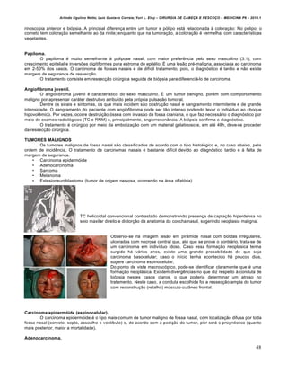 Arlindo Ugulino Netto; Luiz Gustavo Correia; Yuri L. Eloy – CIRURGIA DE CABE•A E PESCO•O – MEDICINA P6 – 2010.1
48
rinoscopia anterior e biƒpsia. A principal diferen•a entre um tumor e pƒlipo est‡ relacionada † colora•‚o: No pƒlipo, o
corneto tem colora•‚o semelhante ao da rinite; enquanto que na tumora•‚o, a colora•‚o € vermelha, com caracter„sticas
vegetantes.
Papiloma.
O papiloma € muito semelhante † polipose nasal, com maior preferˆncia pelo sexo masculino (3:1), com
crescimento epitelial e inversŒes digitiformes para estroma do epit€lio. • uma les‚o pr€-maligna, associada ao carcinoma
em 2-50% dos casos. O carcinoma de fossas nasais € de dif„cil tratamento, pois, o diagnƒstico € tardio e n‚o existe
margem de seguran•a de ressec•‚o.
O tratamento consiste em ressec•‚o cirŠrgica seguida de biƒpsia para diferenci‡-lo de carcinoma.
Angiofibroma juvenil.
O angiofibroma juvenil € caracter„stico do sexo masculino. • um tumor benigno, por€m com comportamento
maligno por apresentar car‡ter destrutivo atribu„do pela prƒpria pulsa•‚o tumoral.
Dentre os sinais e sintomas, os que mais incidem s‚o obstru•‚o nasal e sangramento intermitente e de grande
intensidade. O sangramento do paciente com angiofibroma pode ser t‚o intenso podendo levar o indiv„duo ao choque
hipovolˆmico. Por vezes, ocorre destrui•‚o ƒssea com invas‚o da fossa craniana, o que faz necess‡rio o diagnƒstico por
meio de exames radiolƒgicos (TC e RNM) e, principalmente, angiorreson…ncia. A biƒpsia confirma o diagnƒstico.
O tratamento € cirŠrgico por meio da emboliza•‚o com um material gelatinoso e, em at€ 48h, deve-se proceder
da ressec•‚o cirŠrgica.
TUMORES MALIGNOS
Os tumores malignos de fossa nasal s‚o classificados de acordo com o tipo histolƒgico e, no caso abaixo, pela
ordem de incidˆncia. O tratamento de carcinomas nasais € bastante dif„cil devido ao diagnƒstico tardio e † falta de
margem de seguran•a.
• Carcinoma epidermƒide
• Adenocarcinoma
• Sarcoma
• Melanoma
• Estesioneuroblastoma (tumor de origem nervosa, ocorrendo na ‡rea olfatƒria)
TC helicoidal convencional contrastado demonstrando presen•a de capta•‚o hiperdensa no
seio maxilar direito e distor•‚o da anatomia da concha nasal, sugerindo neoplasia maligna.
Observa-se na imagem les‚o em pir…mide nasal com bordas irregulares,
ulceradas com necrose central que, at€ que se prove o contr‡rio, trata-se de
um carcinoma em indiv„duo idoso. Caso essa forma•‚o neopl‡sica tenha
surgido h‡ v‡rios anos, existe uma grande probabilidade de que seja
carcinoma basocelular; caso o in„cio tenha acontecido h‡ poucos dias,
sugere carcinoma espinocelular.
Do ponto de vista macroscƒpico, pode-se identificar claramente que € uma
forma•‚o neopl‡sica. Existem divergˆncias no que diz respeito † conduta de
biƒpsia nestes casos claros, o que poderia determinar um atraso no
tratamento. Neste caso, a conduta escolhida foi a ressec•‚o ampla do tumor
com reconstru•‚o (retalho) mŠsculo-cut…neo frontal.
Carcinoma epidermóide (espinocelular).
O carcinoma epidermƒide € o tipo mais comum de tumor maligno de fossa nasal, com localiza•‚o difusa por toda
fossa nasal (corneto, septo, assoalho e vest„bulo) e, de acordo com a posi•‚o do tumor, pior ser‡ o prognƒstico (quanto
mais posterior, maior a mortalidade).
Adenocarcinoma.
 