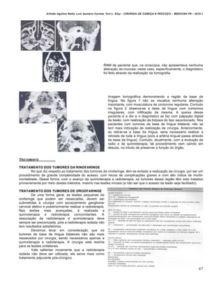 Arlindo Ugulino Netto; Luiz Gustavo Correia; Yuri L. Eloy – CIRURGIA DE CABE•A E PESCO•O – MEDICINA P6 – 2010.1
67
RNM de paciente que, na oroscopia, não apresentava nenhuma
alteração da mucosa; neste caso, especificamente, o diagnóstico
foi feito através da realização da tomografia.
Imagem tomográfica demonstrando a região da base da
língua. Na figura 1 não se visualiza nenhuma alteração
importante, com musculatura de contornos regulares. Contudo
na figura 2 observa-se a base da língua com contornos
irregulares, com infiltração da mesma. A queixa desse
paciente é a dor e o diagnóstico se faz com palpação digital
da lesão, com realização da biópsia do tipo saca-bocado. Nos
pacientes com tumores da base de língua bilateral, não se
tem mais indicação de realização de cirurgia. Anteriormente,
ao retirar-se a base da língua, seria necessário realizar a
retirada de toda a língua (pois a artéria lingual passa através
da base da língua). Contudo, atualmente, com a evolução da
radio e da quimioterapia, tal procedimento vem caindo em
desuso, no intuito de preservar a função do órgão.
TRATAMENTO
TRATAMENTO DOS TUMORES DA RINOFARINGE
No que diz respeito ao tratamento dos tumores da rinofaringe, têm-se evitado a realização da cirurgia, por ser um
procedimento de grande complexidade do acesso, com riscos de complicações graves e com alto índice de morbi-
mortalidade. Dessa forma, com o avanço da quimioterapia e radioterapia, os tumores dessa região têm sido tratados
primariamente por meio destes métodos, mesmo nas lesões iniciais (a não ser que o acesso da lesão seja facilitado).
TRATAMENTO DOS TUMORES DE OROOFARINGE
De uma forma geral, as lesões pequenas de
orofaringe que podem ser ressecadas, devem ser
submetidas à cirurgia com esvaziamento ganglionar
cervical eletivo e posteriormente realizar a radioterapia.
Nas lesões mais avançadas, é realizada a
quimioterapia e radioterapia concomitantes. A
associação da radioterapia e quimioterapia deve
sempre ser preconizada, pois a radioterapia isolada não
tem resultados satisfatórios.
Devemos levar em consideração que os
tumores de base de língua bilaterais não são mais
ressecados por cirurgia, sendo necessários apenas a
quimioterapia e radioterapia. A cirurgia está restrita
para as lesões unilaterais.
Vale salientar novamente que a radioterapia
isolada não deve ser utilizada; ela serve mais como
tratamento adjuvante pós-cirúrgico.
 