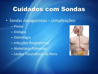 Cuidados com Sondas
• Sondas nasogastricas – complicações:
– Pirose
– Disfagia
– Odinofagia
– Infecções Respiratórias
– Atelectasia Pulmonar
– Lesões Traumáticas do Nariz
 