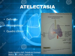 ATELECTASIA
• Definição
• Fisiopatologia
• Quadro clínico
Fonte: Guyton e Hall. Tratado de Fisiologia
Médica. 11ª. Edição, capítulo 42.
 