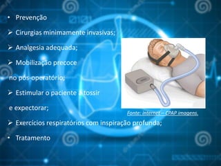 • Prevenção
 Cirurgias minimamente invasivas;
 Analgesia adequada;
 Mobilização precoce
no pós-operatório;
 Estimular o paciente a tossir
e expectorar;
 Exercícios respiratórios com inspiração profunda;
• Tratamento
Fonte: internet – CPAP imagens.
 
