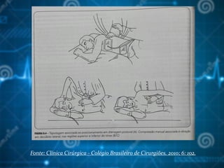 Fonte: Clínica Cirúrgica - Colégio Brasileiro de Cirurgiões. 2010; 6: 102.
 