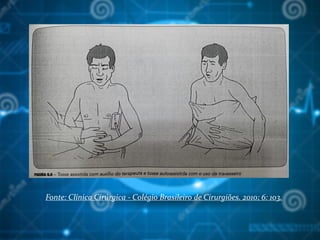 Fonte: Clínica Cirúrgica - Colégio Brasileiro de Cirurgiões. 2010; 6: 103.
 