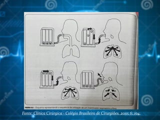 Fonte: Clínica Cirúrgica - Colégio Brasileiro de Cirurgiões. 2010; 6: 104.
 