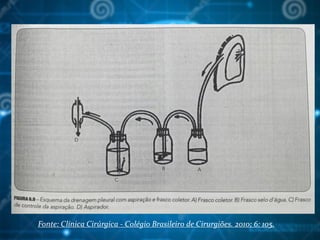 Fonte: Clínica Cirúrgica - Colégio Brasileiro de Cirurgiões. 2010; 6: 105.
 