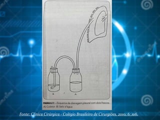 Fonte: Clínica Cirúrgica - Colégio Brasileiro de Cirurgiões. 2010; 6: 106.
 