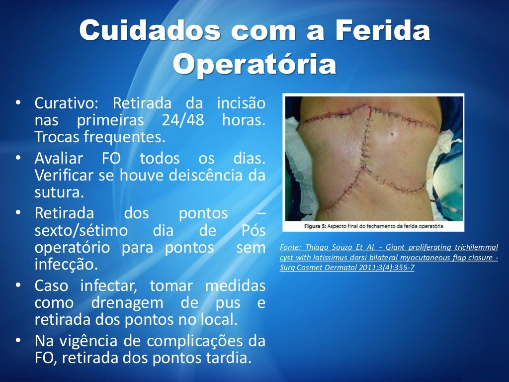 Pós Operatório e Complicações Cirúrgicas