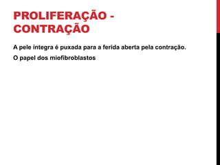 PROLIFERAÇÃO -
CONTRAÇÃO
A pele íntegra é puxada para a ferida aberta pela contração.
O papel dos miofibroblastos
 