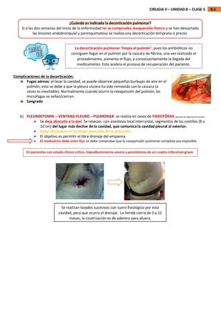 8.5
CIRUGIA II – UNIDAD 8 – CLASE 5
Complicaciones de la decorticación:
Fugas aéreas: al lavar la cavidad, se puede observar pequeñas burbujas de aire en el
pulmón, esto se debe a que la pleura víscera ha sido removido con la cascara (a
veces es inevitable). Normalmente cuando ocurre la reexpansión del pulmón, las
microfugas se sellan/cierran.
Sangrado
6) PLEUROSTOMIA – VENTANA PLEURO – PULMONAR: se realiza en casos de FIBROTÓRAX (periodo de organización tardía).
 Se deja abocada a la piel. Se resecan, con anestesia local intercostal, segmentos de las costillas (8 a
10 cm) del lugar más declive de la cavidad, que comunica la cavidad pleural al exterior.
 Debe efectuarse en la etapa avanzada de la colección.
 El objetivo es permitir el libre drenaje del empiema.
 El mediastino debe estar fijo: se debe comprobar que la reexpansión pulmonar completa sea imposible.
¿Cuándo es indicada la decorticación pulmonar?
Si a las dos semanas del inicio de la enfermedad no se comprueba reexpansión franca y se han descartado
las lesiones endobronquial y parenquimatosa se realiza una decorticación temprana o precoz.
La decorticación pulmonar ‘limpia el pulmón’: pues los antibióticos no
consiguen llegar en el pulmón por la cascara de fibrina, una vez realizado el
procedimiento, aumenta el flujo, y consecuentemente la llegada del
medicamento. Esto acelera el proceso de recuperación del paciente.
En pacientes con estado clínico crítico, hipoalbuminemia severa y persistencia de un cuadro infeccioso grave.
Se realizan lavados sucesivos con suero fisiológico por esta
cavidad, para que ocurra el drenaje. La herida cierra de 3 a 12
meses, la cicatrización es de adentro para afuera.
 